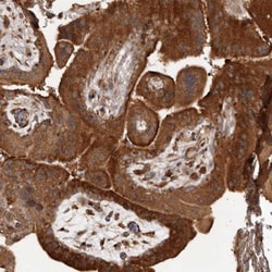 SLC22A3 Antibody, Novus Biologicals 0.1mL; Unlabeled:Antibodies, Polyclonal